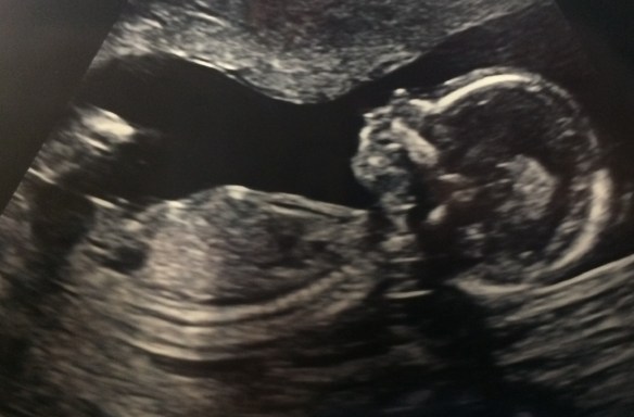 no details baby photo.jpg